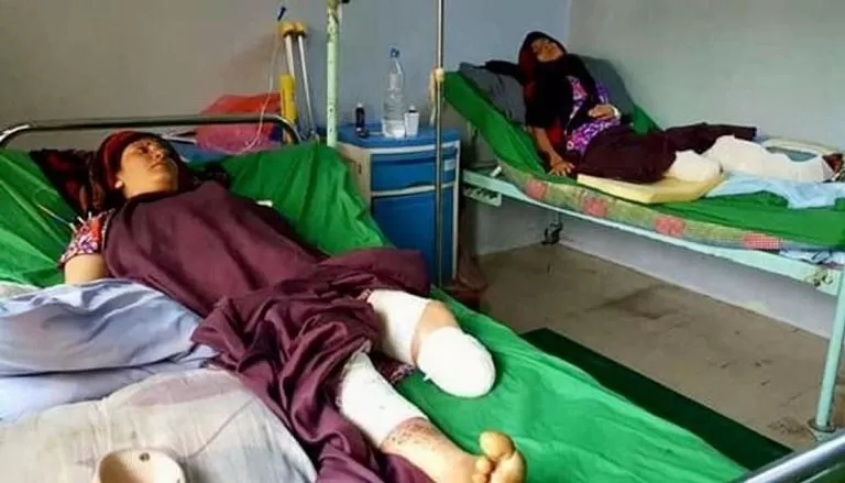مركز حقوقي يطالب بتحرك دولي لتطهير اليمن من ألغام الحوثي