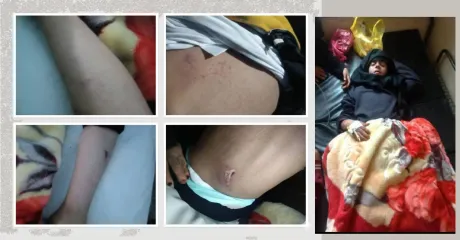 مسك.. طفلة تبحث عن العدالة وسط ضغوط على الأسرة للتنازل